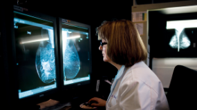 Northwestern Medicine physician reviewing breast scan