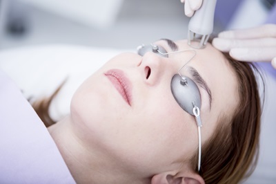 Facial Laser Procedure in Forehead Area