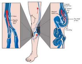 northwestern-medicine-venous-system